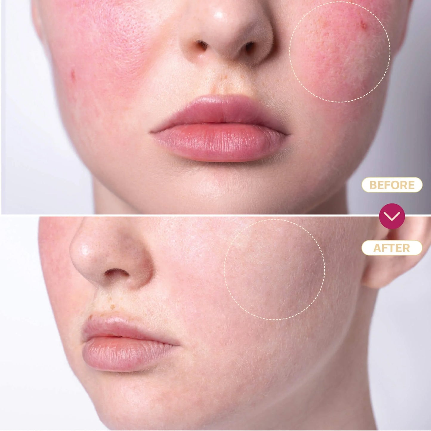 Hypochlorous Acid Spray