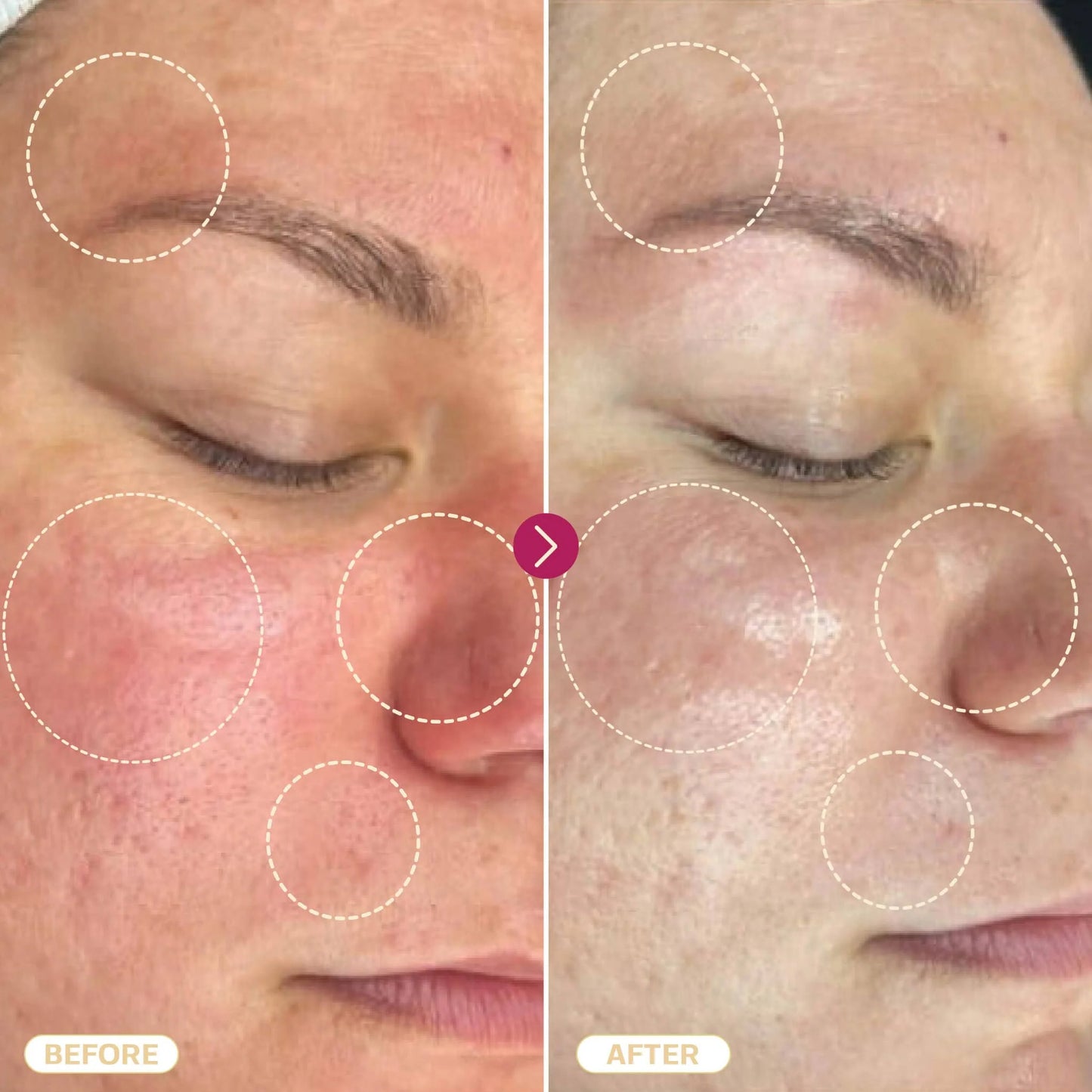 Hypochlorous Acid Spray